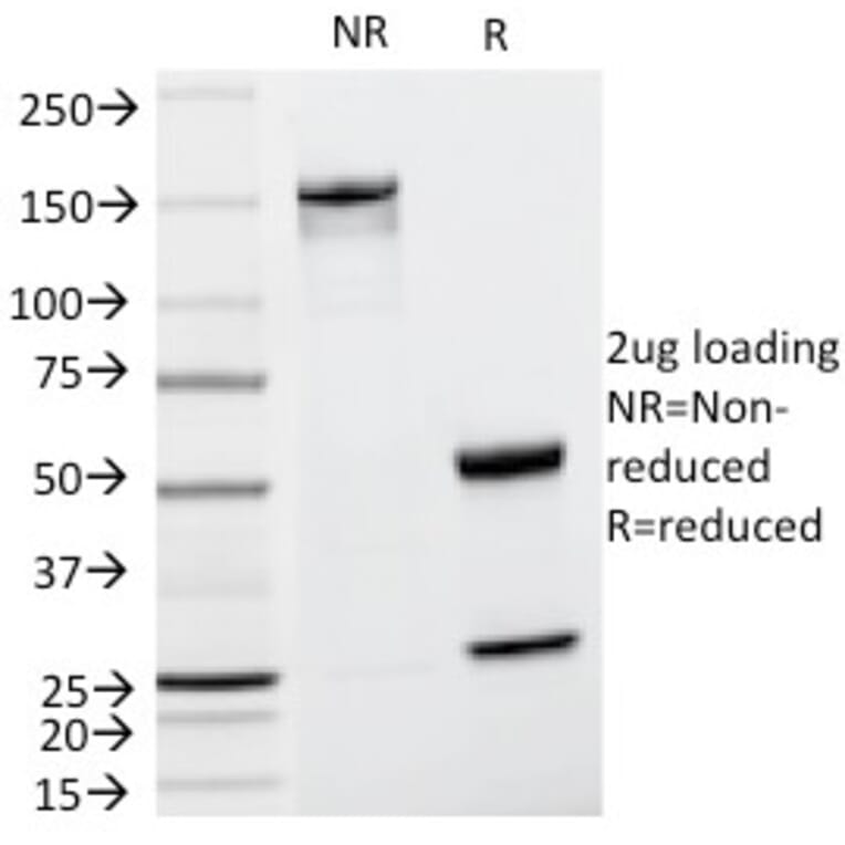 SDS-PAGE - Anti-Cyclin D1 Antibody [CCND1/809] (A249858) - Antibodies.com