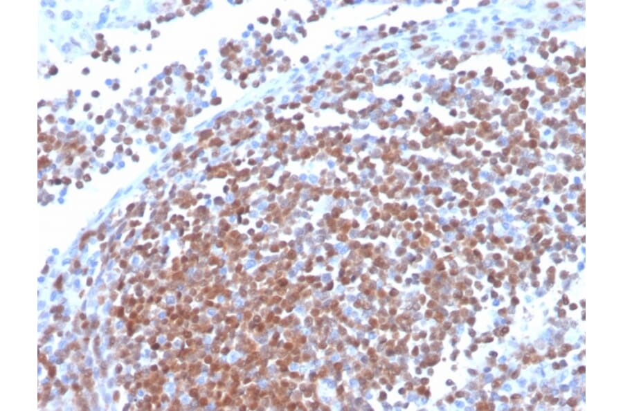 Immunohistochemistry - Anti-Cyclin D1 Antibody [CCND1/3370R] (A249861) - Antibodies.com