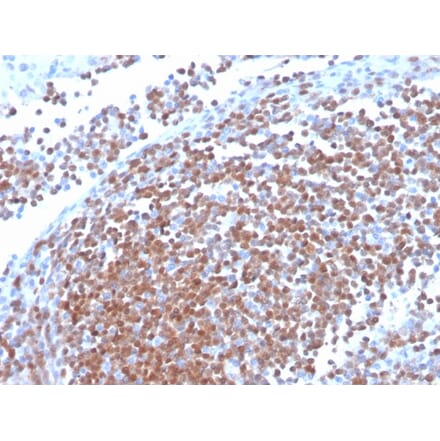 Immunohistochemistry - Anti-Cyclin D1 Antibody [CCND1/3370R] (A249861) - Antibodies.com