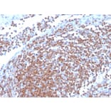 Immunohistochemistry - Anti-Cyclin D1 Antibody [CCND1/3370R] (A249861) - Antibodies.com