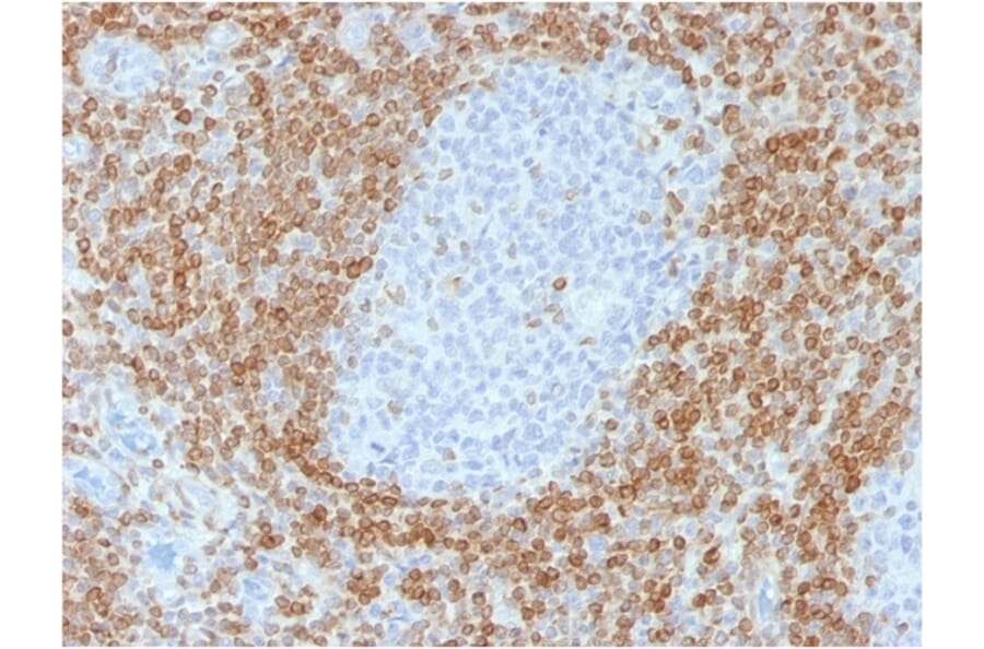 Immunohistochemistry - Anti-Bcl-2 Antibody [rBCL2/782] (A249862) - Antibodies.com