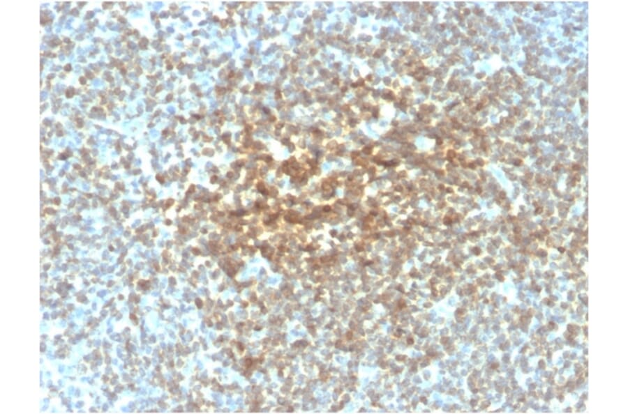 Immunohistochemistry - Anti-Bcl-2 Antibody [rBCL2/782] (A249862) - Antibodies.com