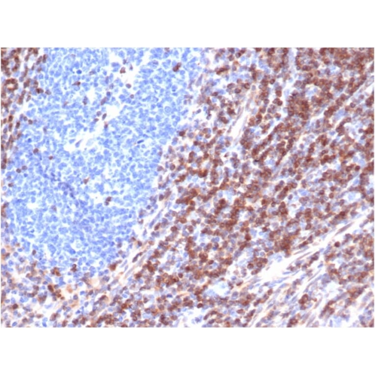 Immunohistochemistry - Anti-Bcl-2 Antibody [rBCL2/6418] (A249862) - Antibodies.com