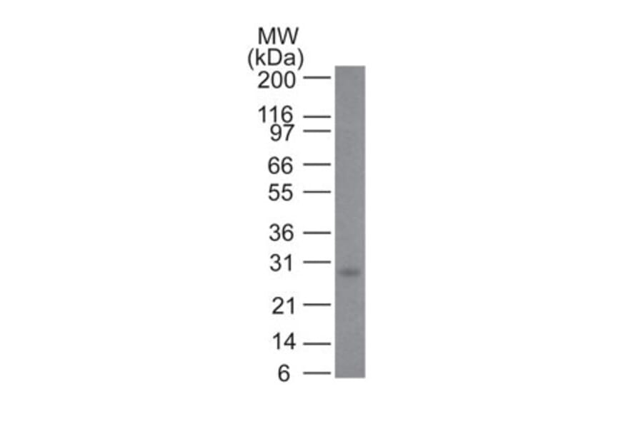 Western Blot - Anti-Bcl-2 Antibody [100/D5] (A249864) - Antibodies.com