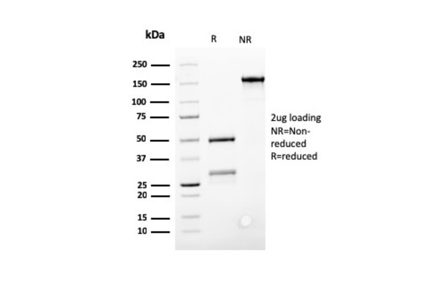 SDS-PAGE - Anti-Bcl-2 Antibody [SPM117] (A249865) - Antibodies.com