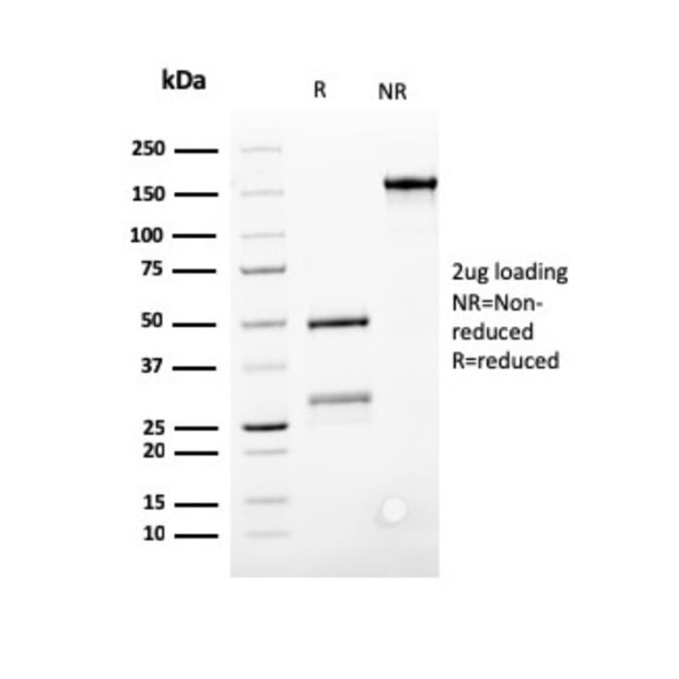 SDS-PAGE - Anti-Bcl-2 Antibody [SPM117] (A249865) - Antibodies.com