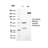 SDS-PAGE - Anti-Bcl-2 Antibody [SPM117] (A249865) - Antibodies.com