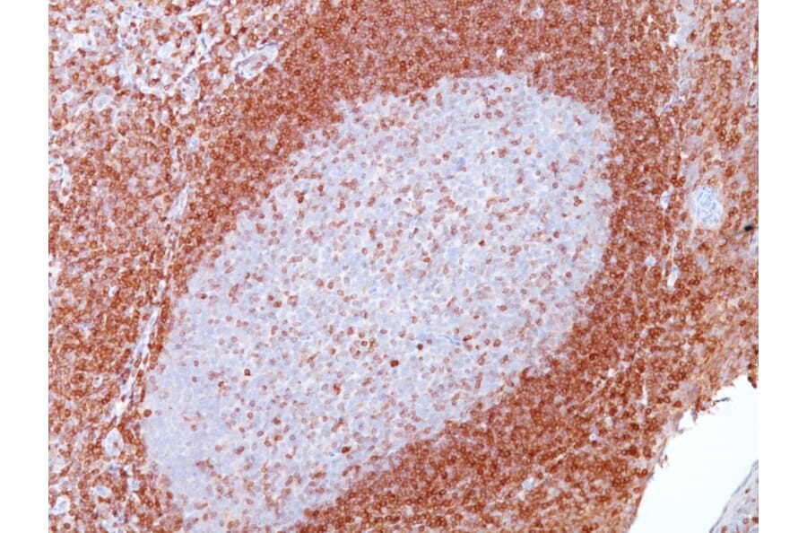 Immunohistochemistry - Anti-Bcl-2 Antibody [SPM117] (A249864) - Antibodies.com