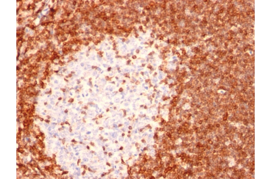 Immunohistochemistry - Anti-Bcl-2 Antibody [8C8] (A249865) - Antibodies.com