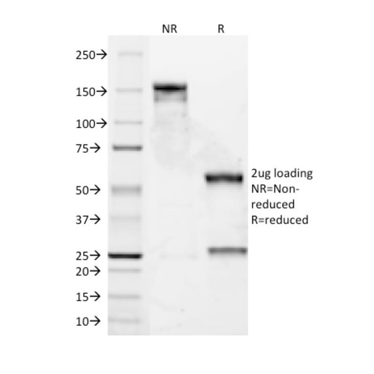 SDS-PAGE - Anti-Bcl-2 Antibody [8C8] (A249866) - Antibodies.com