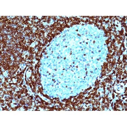 Immunohistochemistry - Anti-Bcl-2 Antibody [124] (A249866) - Antibodies.com