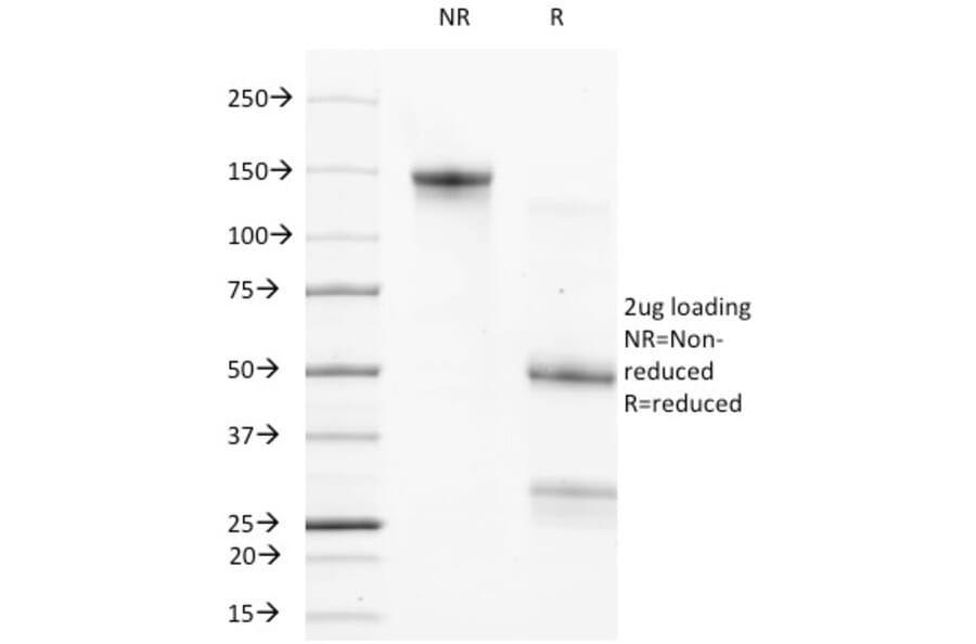 SDS-PAGE - Anti-Bcl-2 Antibody [124] (A249867) - Antibodies.com