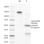 SDS-PAGE - Anti-Bcl-2 Antibody [124] (A249867) - Antibodies.com