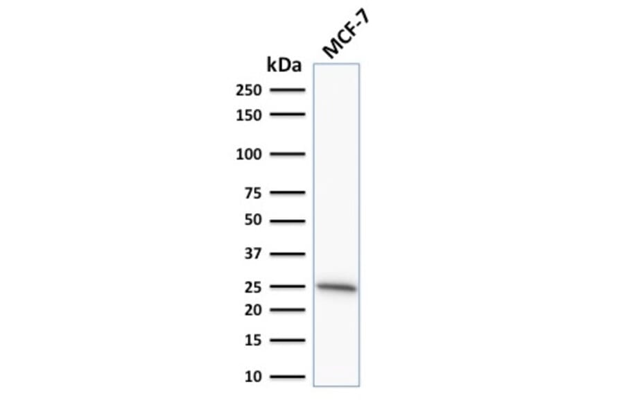 Western Blot - Anti-Bcl-2 Antibody [SPM530] (A249868) - Antibodies.com