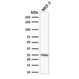 Western Blot - Anti-Bcl-2 Antibody [SPM530] (A249868) - Antibodies.com