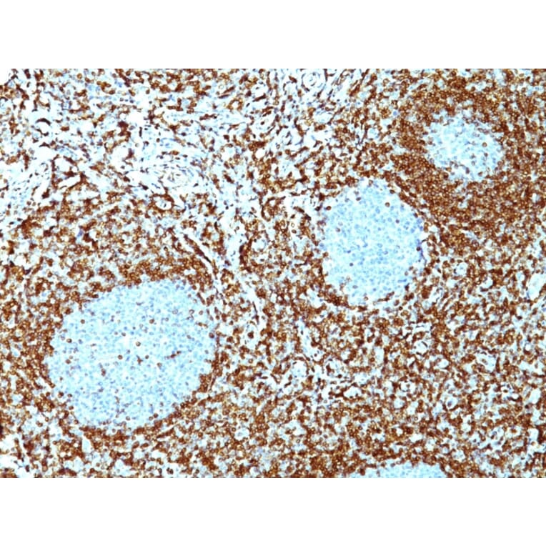 Immunohistochemistry - Anti-Bcl-2 Antibody [100/D5+124] (A249868) - Antibodies.com