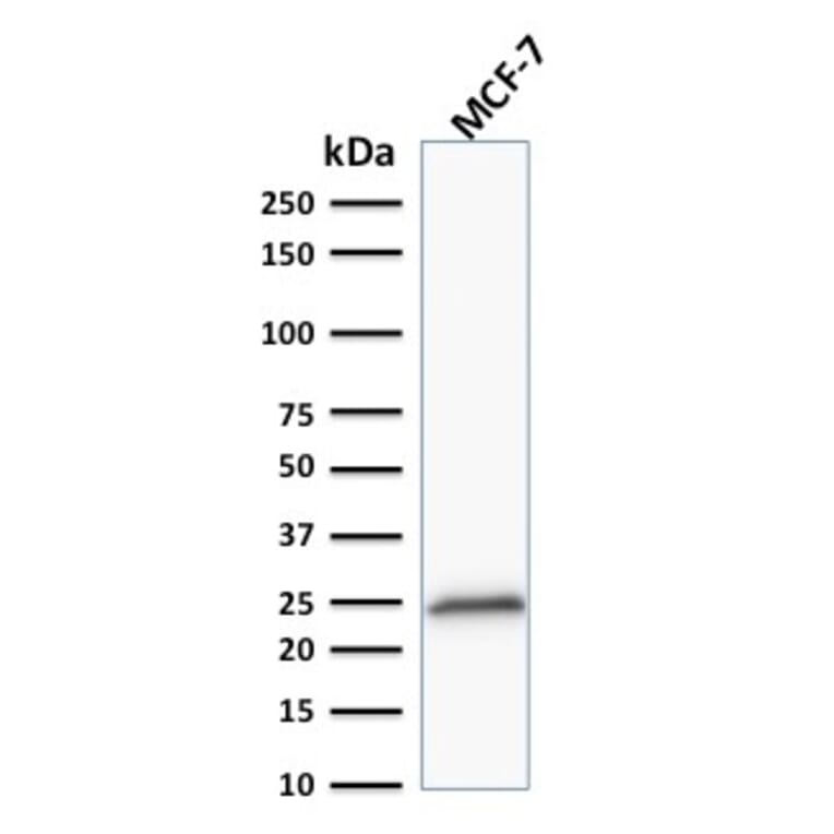 Western Blot - Anti-Bcl-2 Antibody [100/D5+124] (A249869) - Antibodies.com