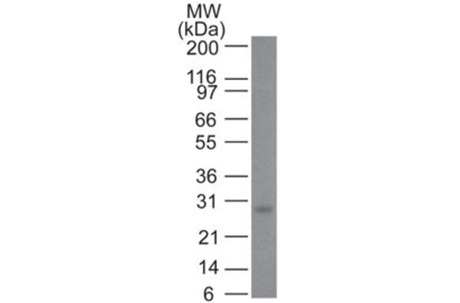 Western Blot - Anti-Bcl-2 Antibody [100/D5+124] (A249869) - Antibodies.com