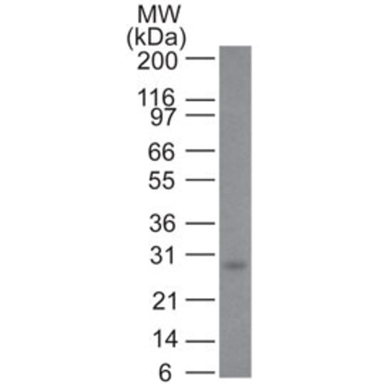 Western Blot - Anti-Bcl-2 Antibody [100/D5+124] (A249869) - Antibodies.com