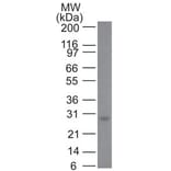 Western Blot - Anti-Bcl-2 Antibody [100/D5+124] (A249869) - Antibodies.com