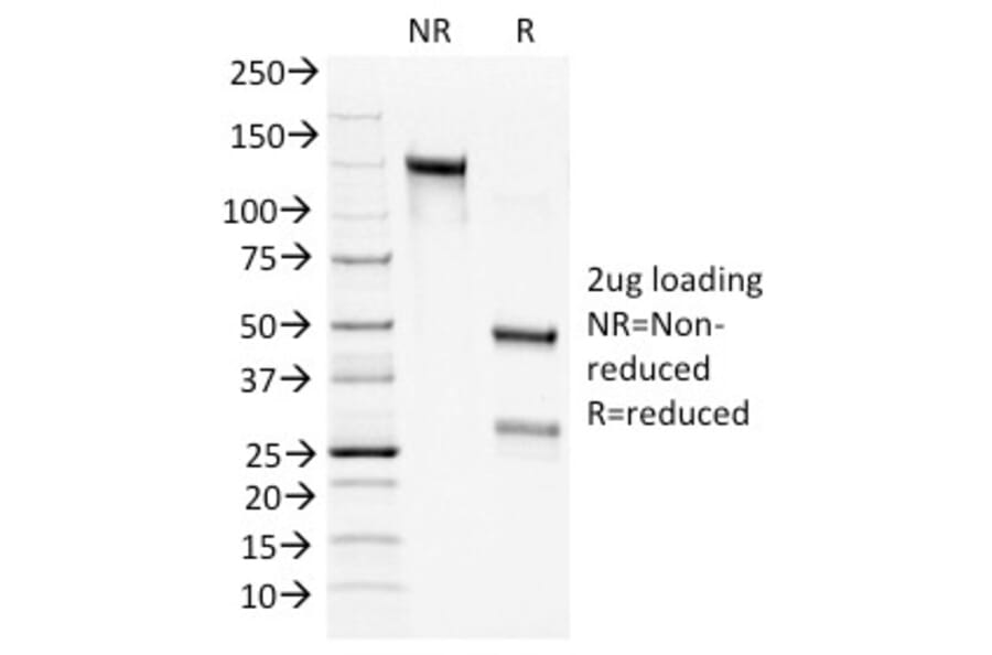 SDS-PAGE - Anti-Bcl-2 Antibody [100/D5+124] (A249869) - Antibodies.com