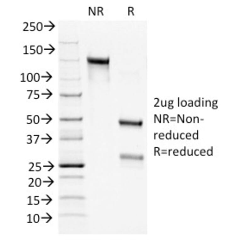 SDS-PAGE - Anti-Bcl-2 Antibody [100/D5+124] (A249869) - Antibodies.com