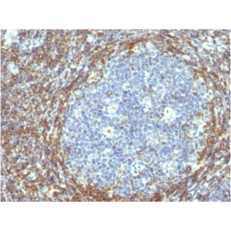 Immunohistochemistry - Anti-Bcl-2 Antibody [BCL2/782] (A249870) - Antibodies.com