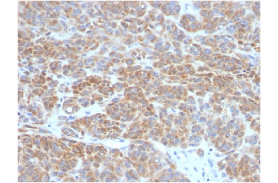 Immunohistochemistry - Anti-Bcl-2 Antibody [BCL2/782] (A249869) - Antibodies.com