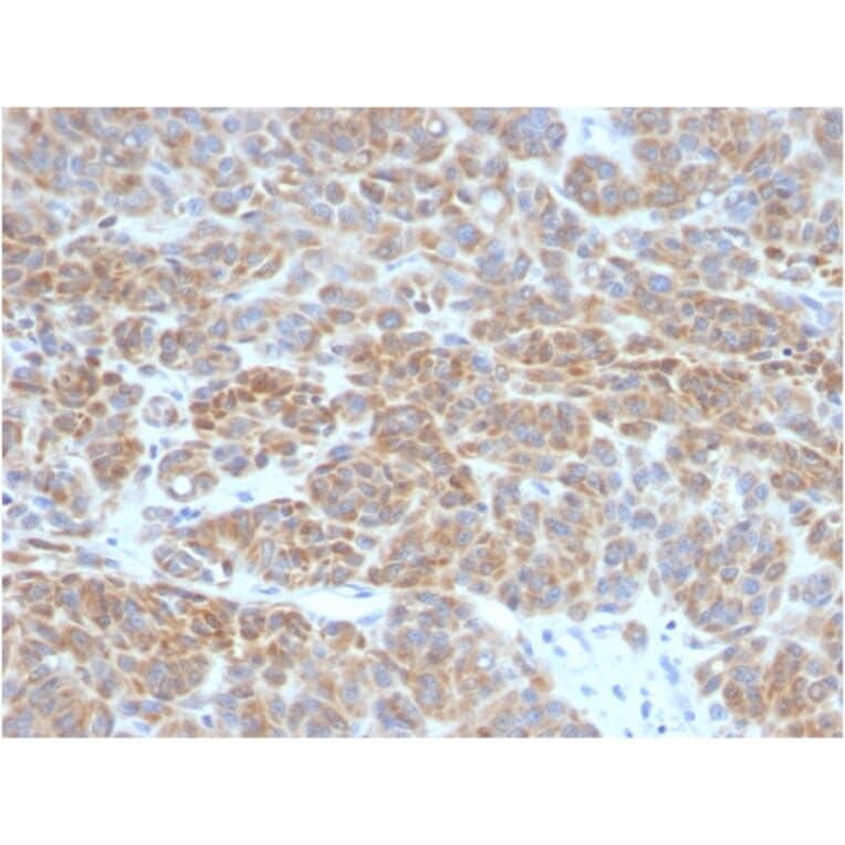 Immunohistochemistry - Anti-Bcl-2 Antibody [BCL2/782] (A249869) - Antibodies.com