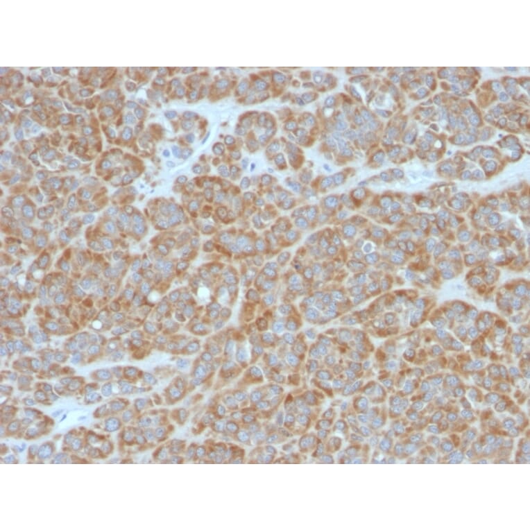 Immunohistochemistry - Anti-Bcl-2 Antibody [BCL2/796] (A249870) - Antibodies.com