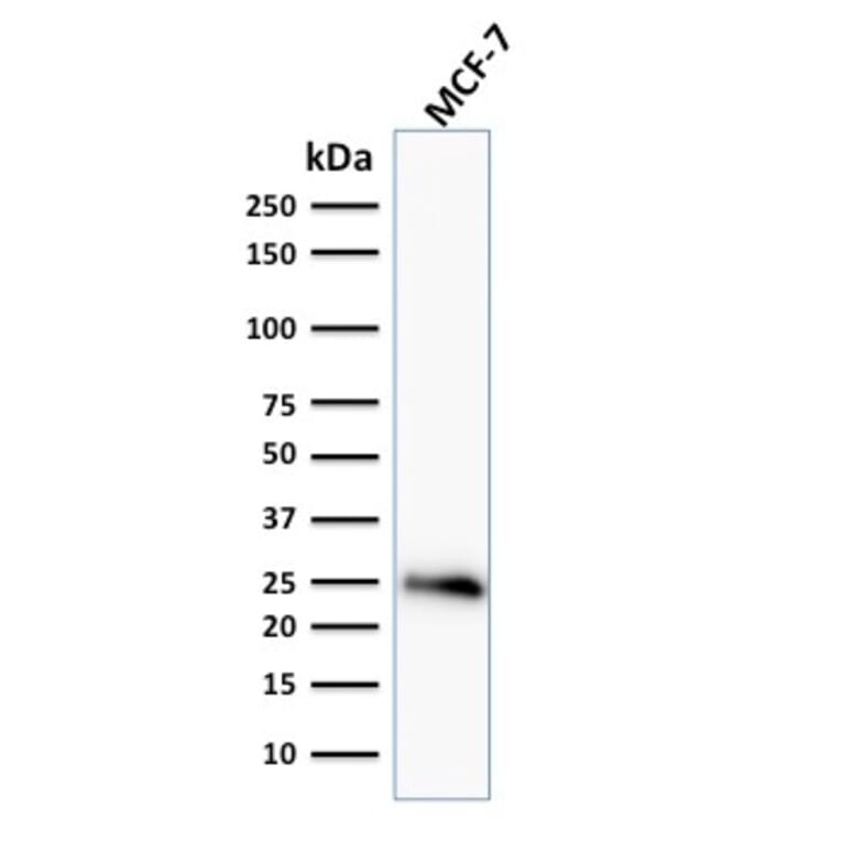 Western Blot - Anti-Bcl-2 Antibody [BCL2/796] (A249871) - Antibodies.com