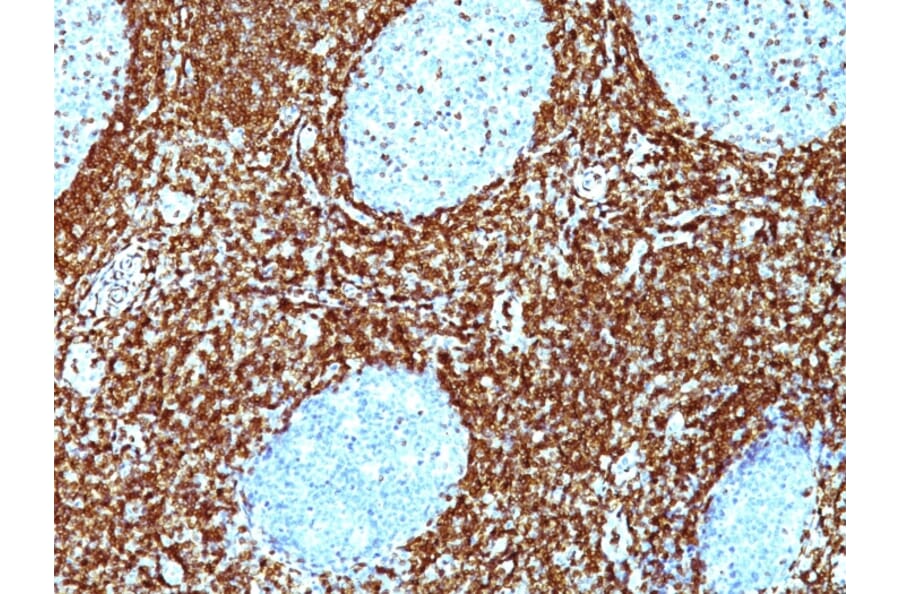 Immunohistochemistry - Anti-Bcl-2 Antibody [BCL2/782 + BCL2/796] (A249872) - Antibodies.com