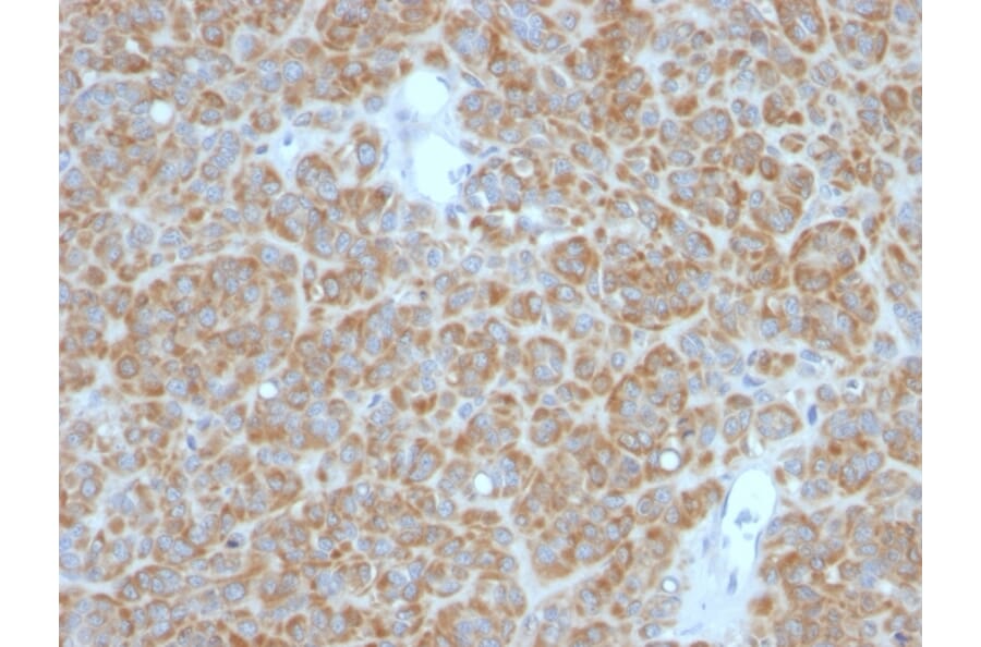 Immunohistochemistry - Anti-Bcl-2 Antibody [BCL2/782 + BCL2/796] (A249871) - Antibodies.com