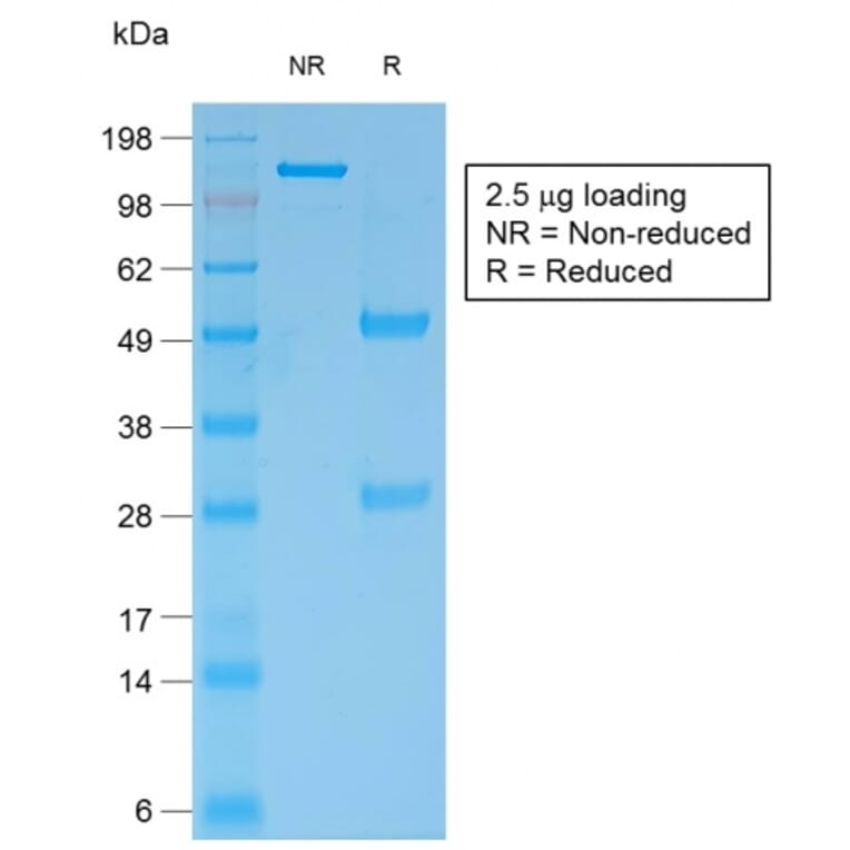 SDS-PAGE - Anti-Bcl-2 Antibody [rBCL2/796] (A249873) - Antibodies.com