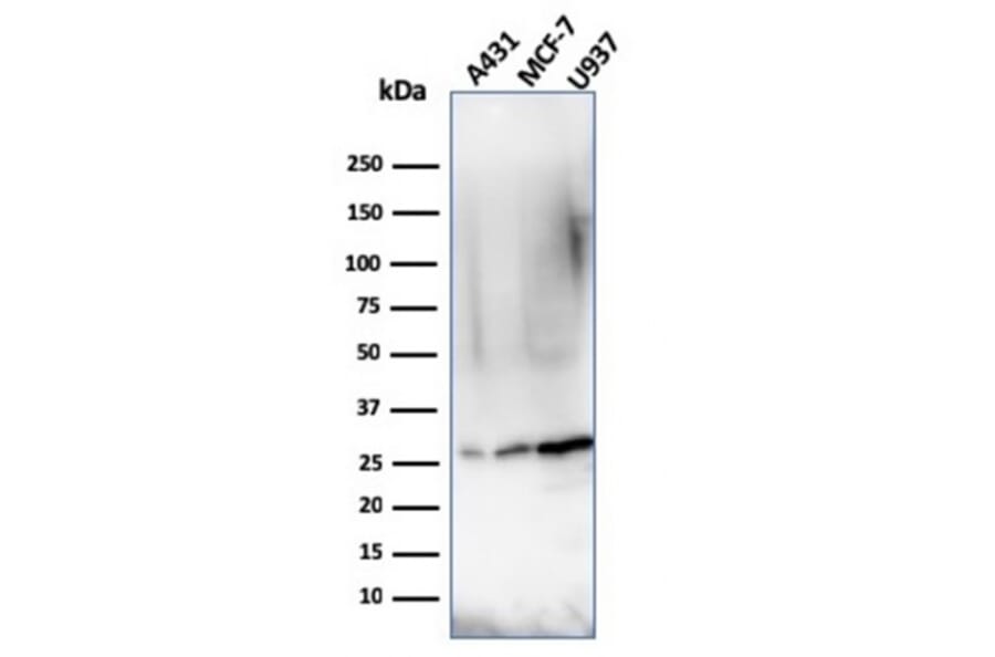 Western Blot - Anti-Bcl-2 Antibody [rBCL2/796] (A249873) - Antibodies.com