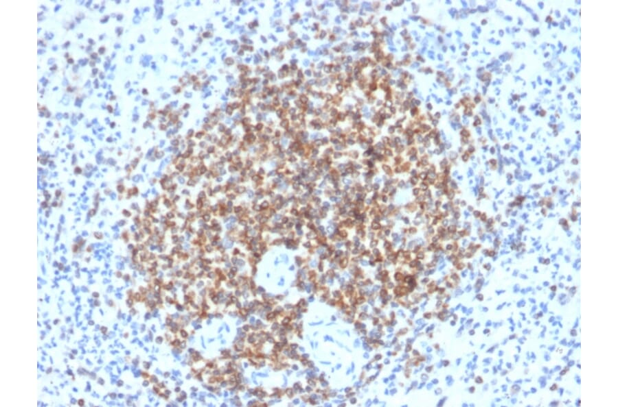 Immunohistochemistry - Anti-Bcl-2 Antibody [BCL2/2210R] (A249874) - Antibodies.com