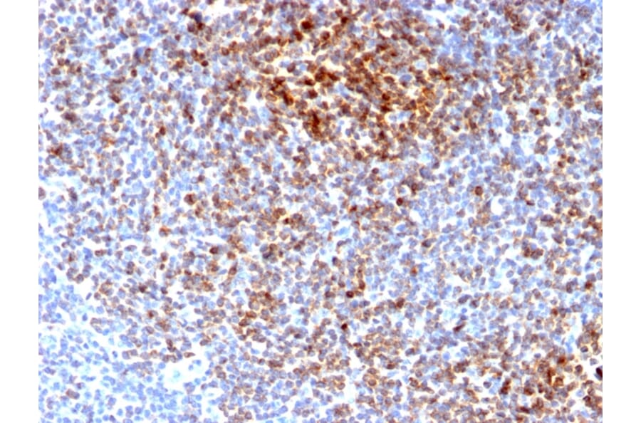 Immunohistochemistry - Anti-Bcl-2 Antibody [BCL2/2210R] (A249874) - Antibodies.com
