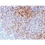 Immunohistochemistry - Anti-Bcl-2 Antibody [BCL2/2210R] (A249874) - Antibodies.com