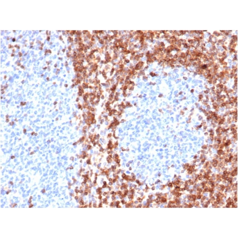 Immunohistochemistry - Anti-Bcl-2 Antibody [BCL2/6426R] (A249874) - Antibodies.com