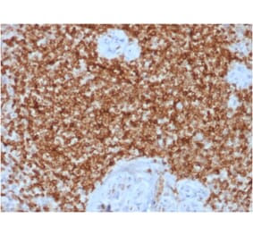 Immunohistochemistry - Anti-Bcl-2 Antibody [BCL2/1878R] (A249875) - Antibodies.com