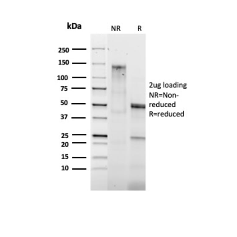 SDS-PAGE - Anti-Bcl-2 Antibody [BCL2/1878R] (A249876) - Antibodies.com