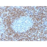 Immunohistochemistry - Anti-Bcl-2 Antibody [BCL2/1878R] (A249876) - Antibodies.com