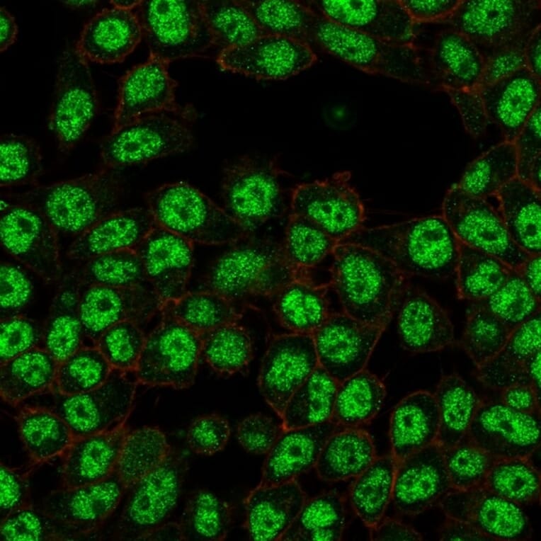 Immunofluorescence - Anti-NF-kB p65 Antibody [PCRP-RELA-2B6] (A249878) - Antibodies.com