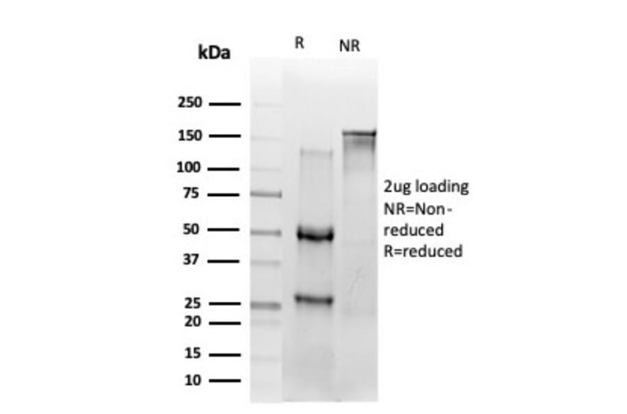 SDS-PAGE - Anti-NF-kB p65 Antibody [PCRP-RELA-2B6] (A249878) - Antibodies.com