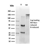 SDS-PAGE - Anti-NF-kB p65 Antibody [PCRP-RELA-2B6] (A249878) - Antibodies.com