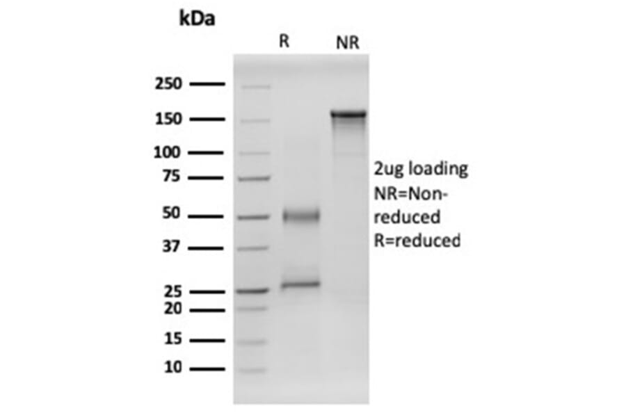 SDS-PAGE - Anti-RET Antibody [RET/2599] (A249879) - Antibodies.com