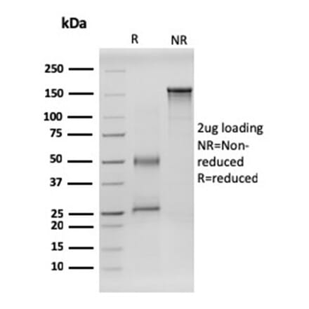 SDS-PAGE - Anti-RET Antibody [RET/2599] (A249879) - Antibodies.com
