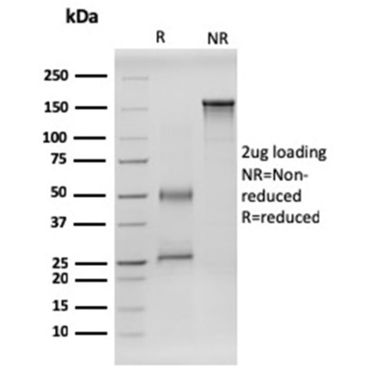 SDS-PAGE - Anti-RET Antibody [RET/2599] (A249879) - Antibodies.com