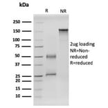 SDS-PAGE - Anti-RET Antibody [RET/2599] (A249879) - Antibodies.com