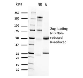 SDS-PAGE - Anti-RET Antibody [RET/2662] (A249880) - Antibodies.com